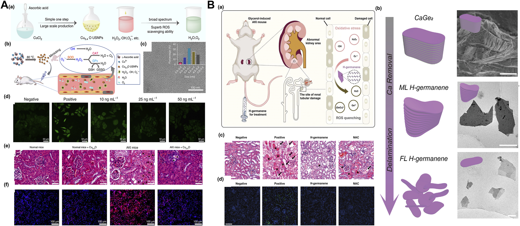 Frontiers | Nanosystems for oxidative stress regulation in the
